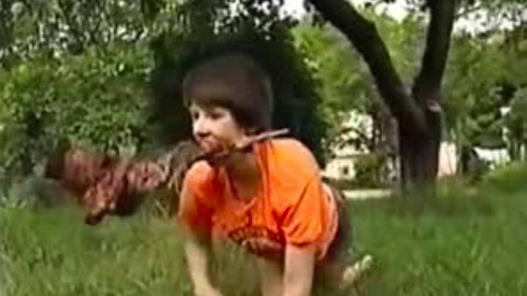 Köpekler tarafından büyütülmüştü, doktorlardan şoke eden rapor! Bir daha asla... 4